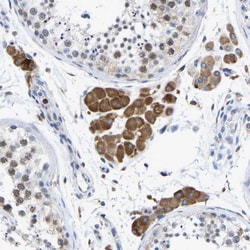 Protein Disulfide Isomerase/P4HB Antibody, Novus Biologicals:Antibodies:Primary